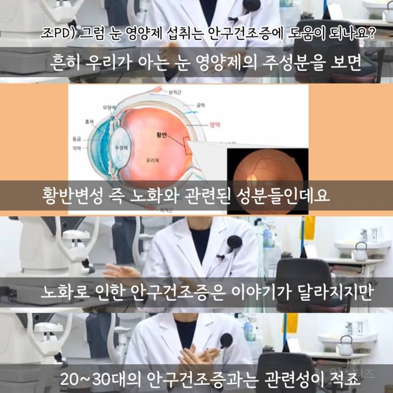 안구건조증에 영양제가 도움이 될까? | 인스티즈