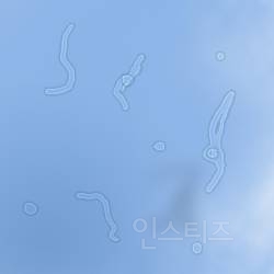 한번 걸리면 우울증 터지는 병 | 인스티즈