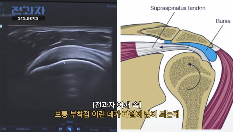 한의학과 수업 듣다가 갑자기 침 맞는 전과자 이창섭.jpg | 인스티즈