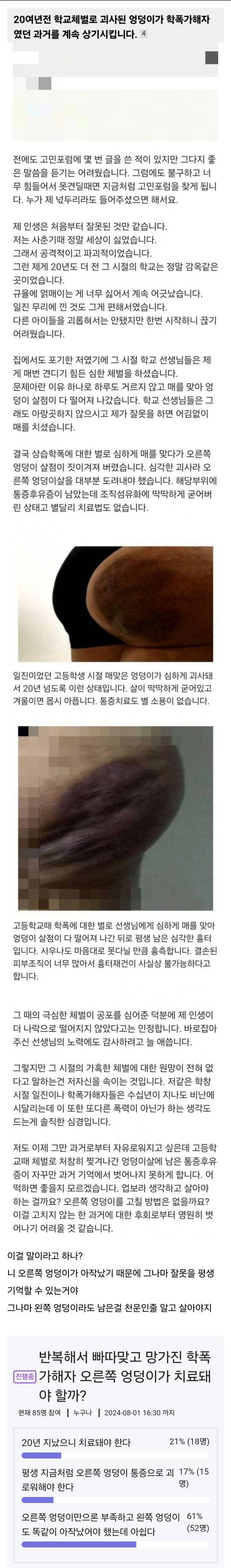 [잡담] 2000년대 학폭가해자의 원망과 불평 | 인스티즈