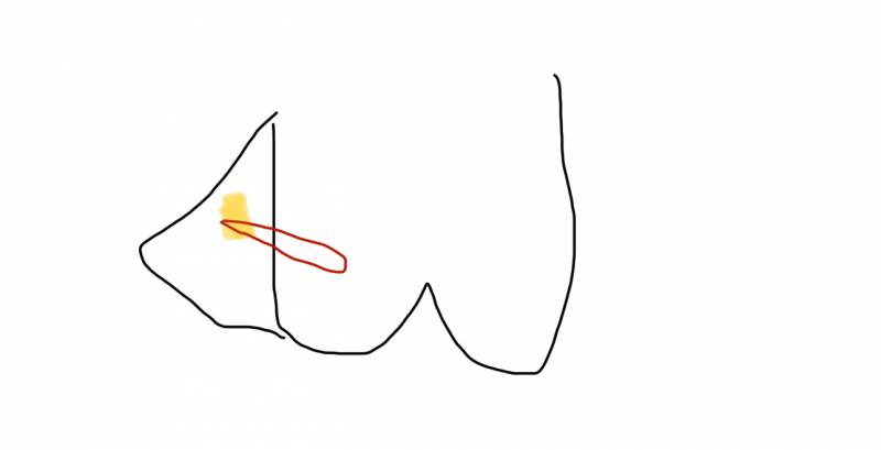 [잡담] 치과 잘 아는 익 있어? | 인스티즈