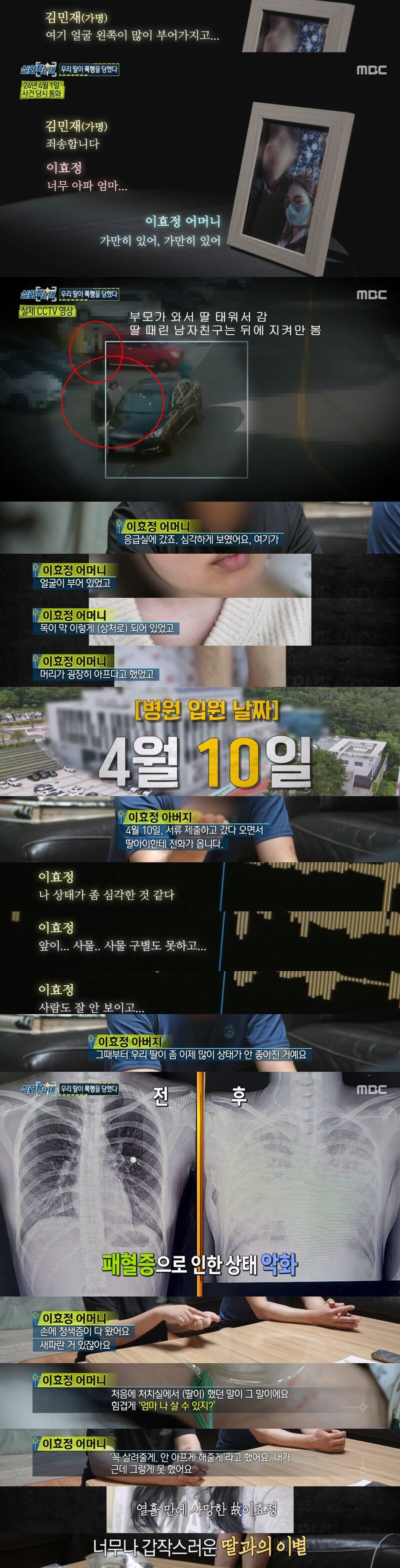 여자친구가 폭행 당한 후 합병증으로 사망했는데 태연하게 자빠져자고 자랑하고다닌 놈 | 인스티즈