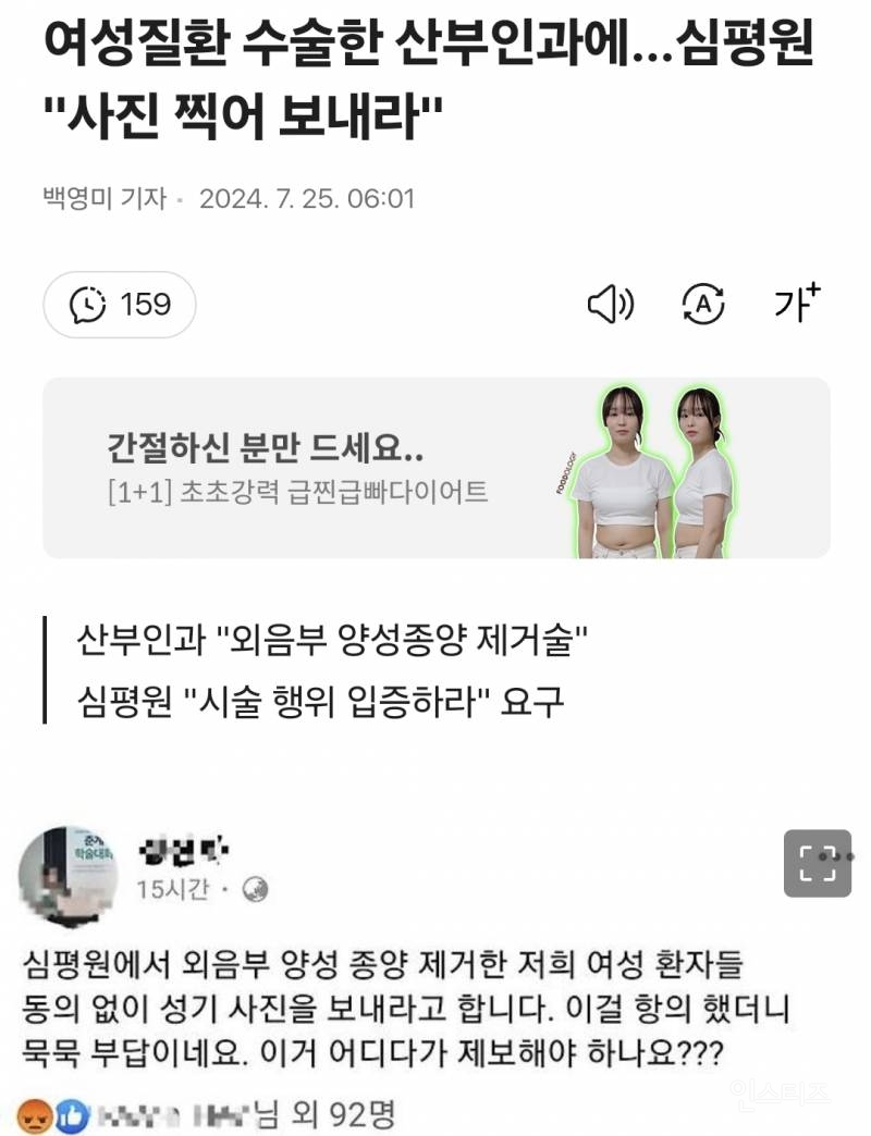 여성질환 수술한 산부인과에…심평원 "사진 찍어 보내라" | 인스티즈