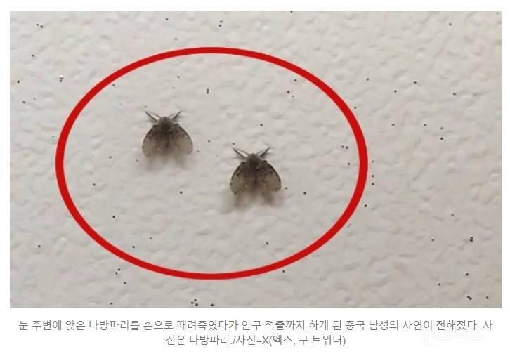 '화장실 파리'가 얼굴에, 잡았다가 '눈 퉁퉁'…안구 적출한 중국 남성 | 인스티즈