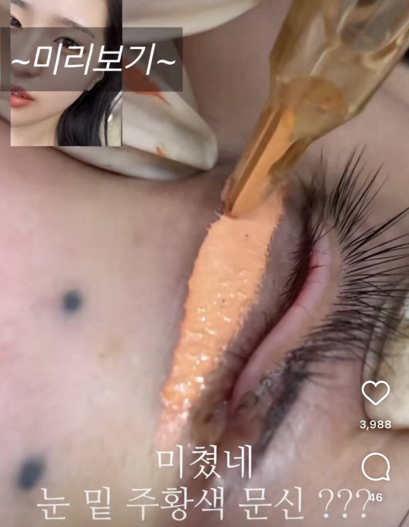 눈 밑 애교살 반영구..jpg | 인스티즈