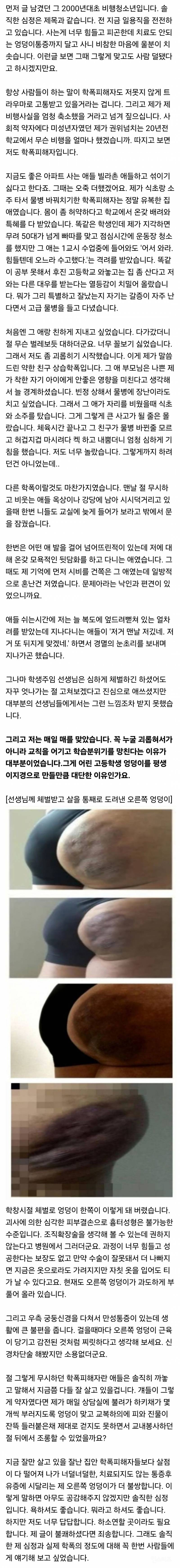 학폭피해자보다 과한 체벌받은 자기 엉덩이가 더 불쌍하다는 학폭가해자 | 인스티즈