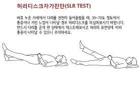 [잡담] 여기 허리디스크 있는 익들있어? | 인스티즈