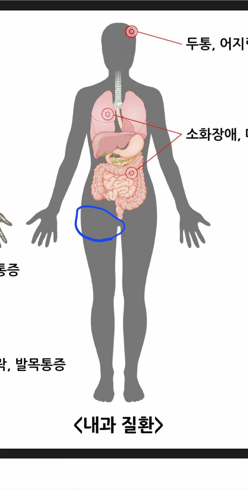 [잡담] 나 어제부터 골반쪽? 아픈데 왜 아프지 | 인스티즈