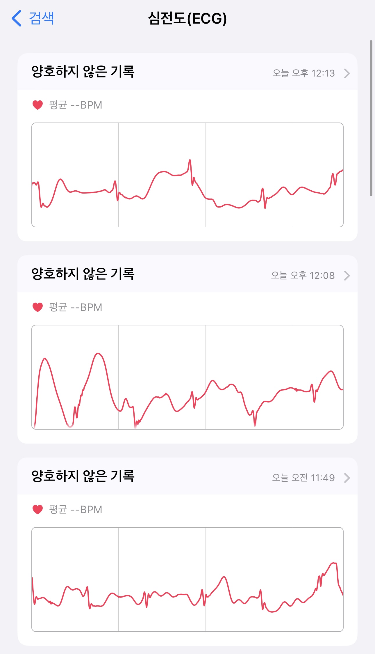 [잡담] 얘드라 제발 도와줘!!! 나 응급실 가야되는거야? | 인스티즈