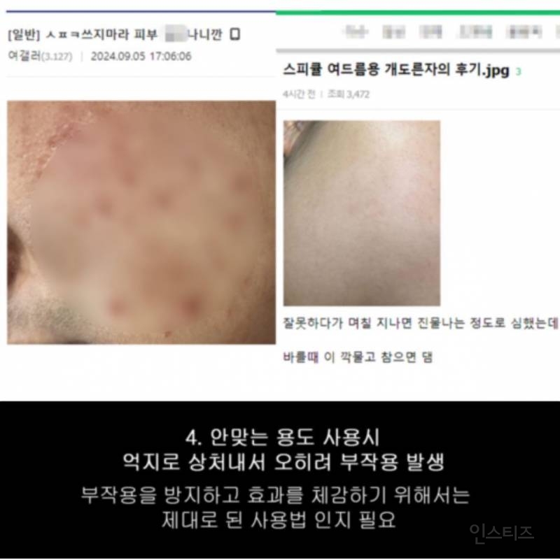 약사가 말하는 스피큘에 얼굴 갈리는 이유.JPG | 인스티즈