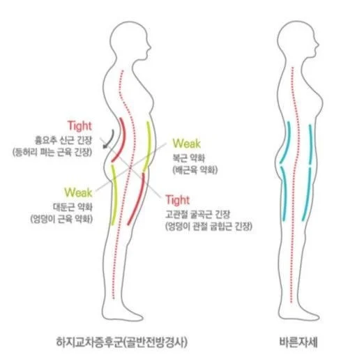 [잡담] 마른비만 아닌데 마른비만처럼 보이는 이유 | 인스티즈