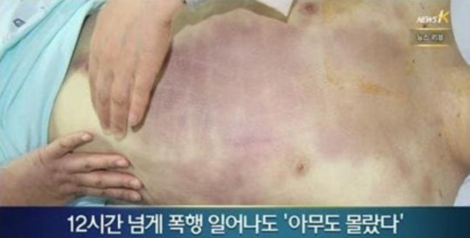 [정보/소식] 벌써 10년 된 윤일병 집단 구타 사망 사건 | 인스티즈