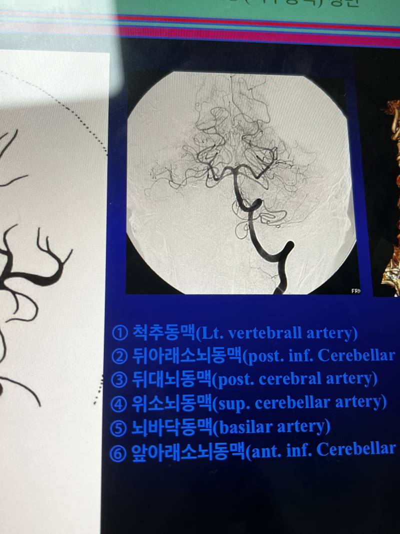 [잡담] 얘들아 혹시 지금 간호익들 있어??ㅠㅠ | 인스티즈