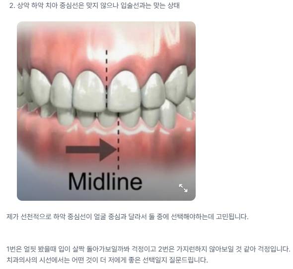 [잡담] 교정에 대해 잘 아는 사람 제발 의료지식 있는사람 제발 중심선 잘 보는사람 제발 | 인스티즈