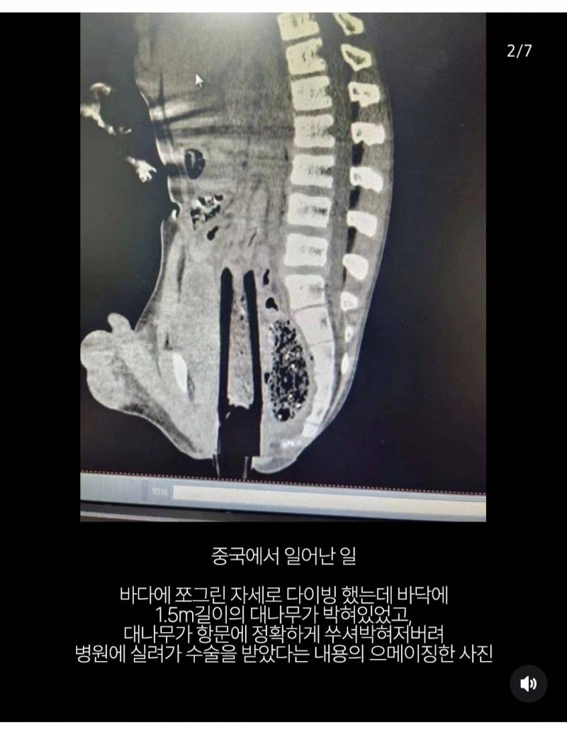 [잡담] 릴스보다가 충격적인거 봤다.....ㅎㅇㅈㅇ | 인스티즈