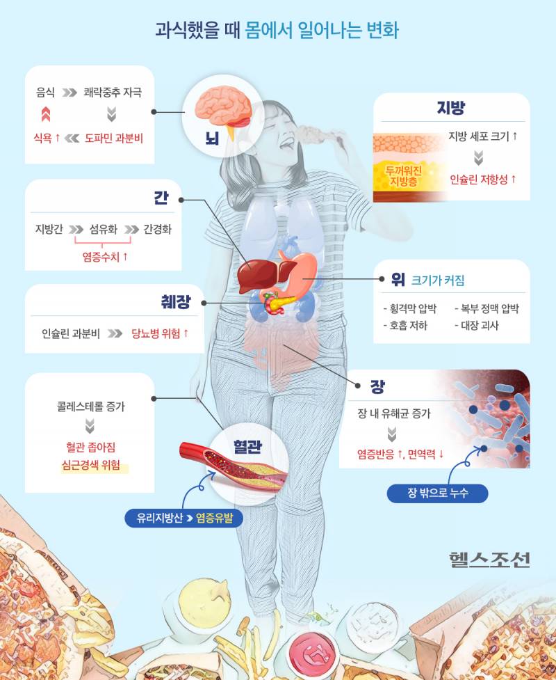 [정보/소식] 먹방 유튜버 줄줄이 사망… 몸 '이렇게' 병들어 갔을 것 | 인스티즈