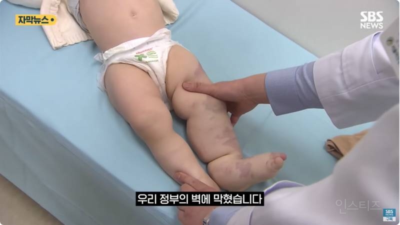 "와 이건 가만히 못 있겠네" 의사와 부모가 기적을 썼다 | 인스티즈