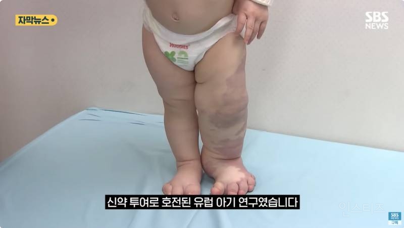 "와 이건 가만히 못 있겠네" 의사와 부모가 기적을 썼다 | 인스티즈