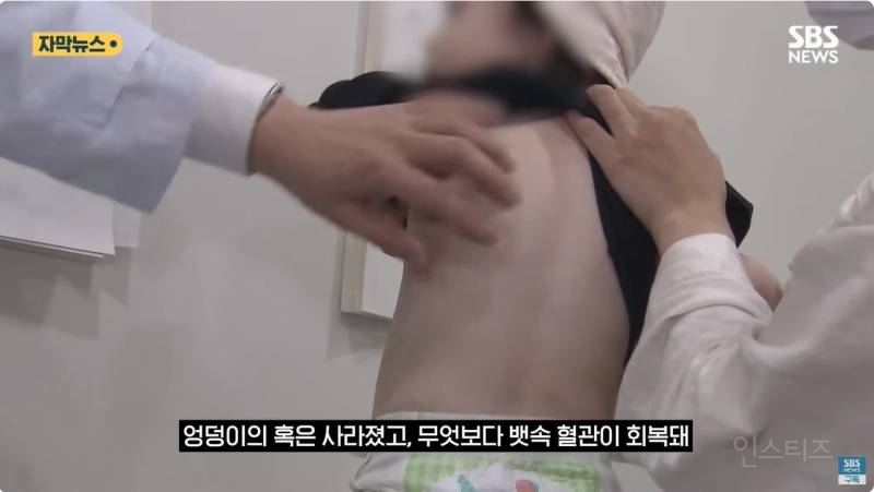 "와 이건 가만히 못 있겠네" 의사와 부모가 기적을 썼다 | 인스티즈