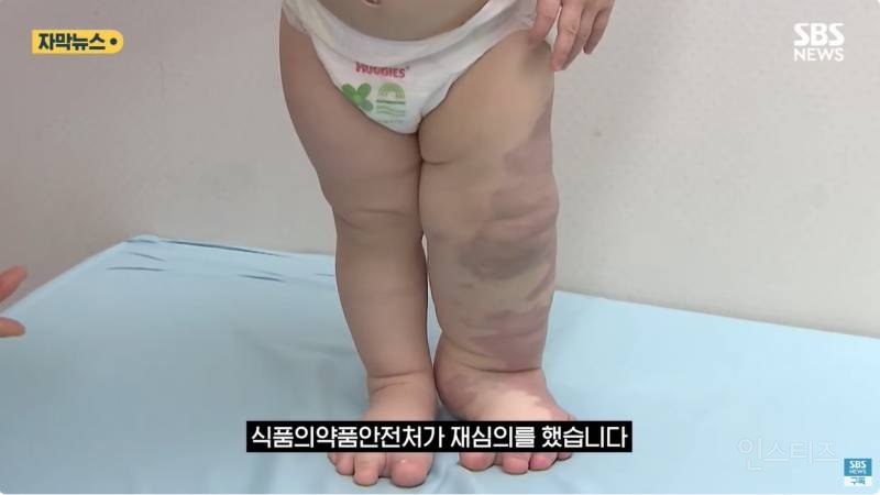 "와 이건 가만히 못 있겠네" 의사와 부모가 기적을 썼다 | 인스티즈