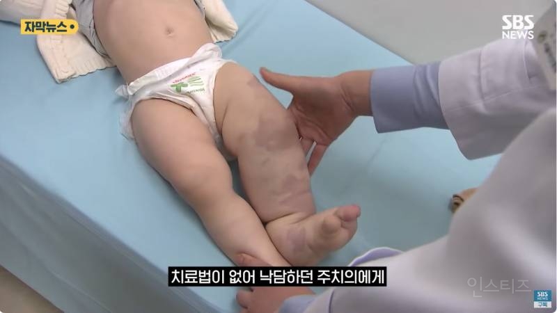 "와 이건 가만히 못 있겠네" 의사와 부모가 기적을 썼다 | 인스티즈