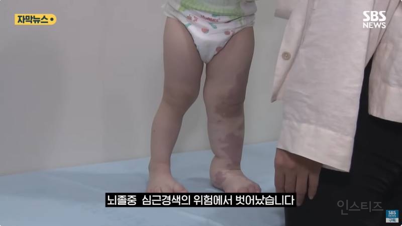 "와 이건 가만히 못 있겠네" 의사와 부모가 기적을 썼다 | 인스티즈