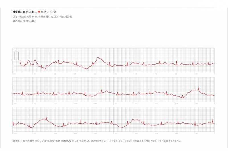 [잡담] 애플워치 심전도 좀 봐줄사람?? | 인스티즈