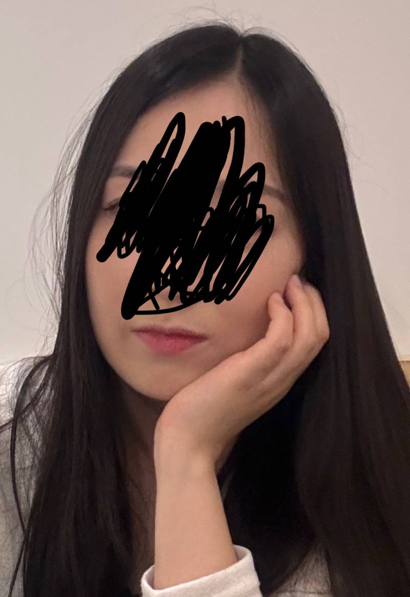 [잡담] 나 입꼬리 보톡스+필러 맞으면 입꼬리 내려가있고 비대칭인거 좀 나아질까?ㅠㅠ 넘 스트레스야ㅠㅠ | 인스티즈