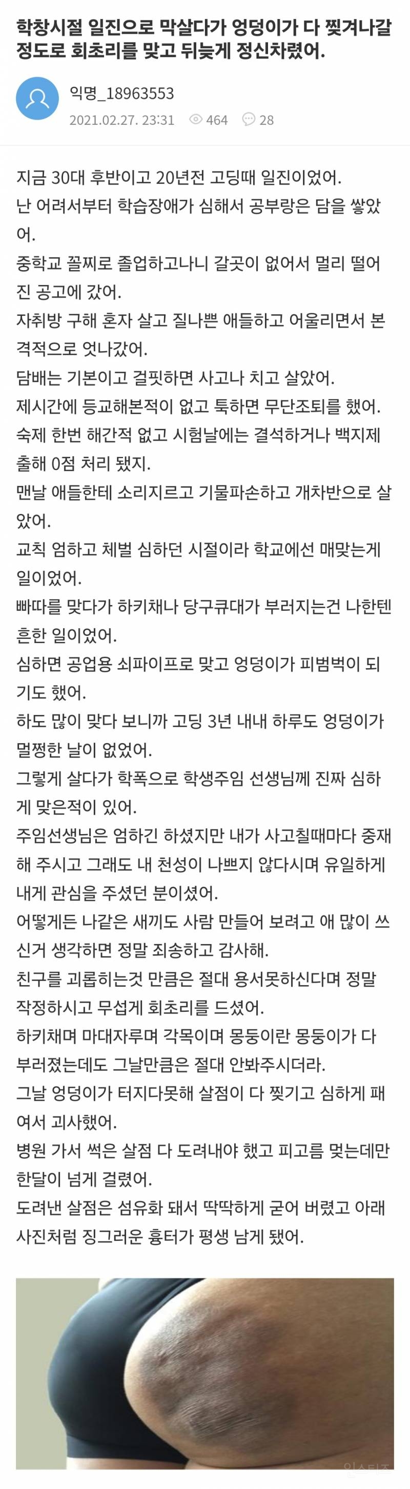 20년전 학교 체벌에 엉덩이살 괴사된 학폭가해자 일진의 반성 코스프레.JPG | 인스티즈