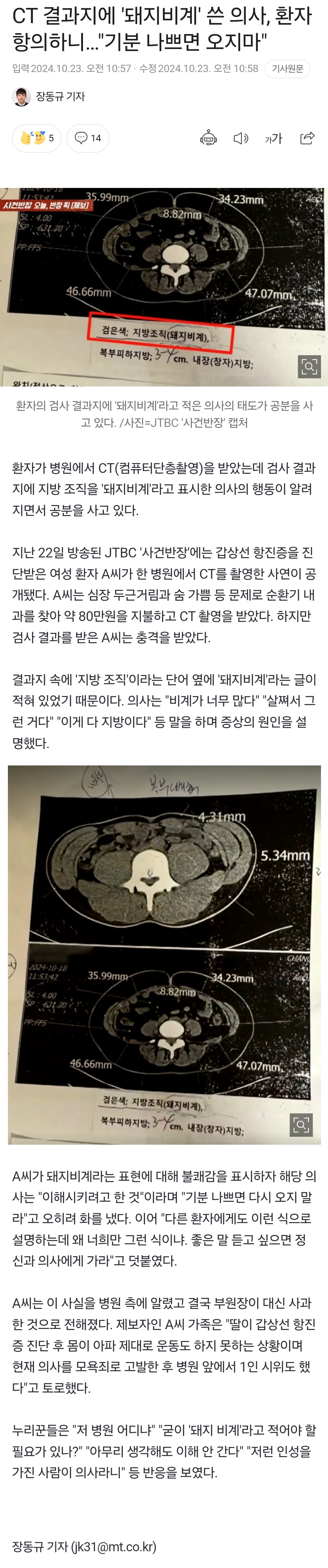 [정보/소식] CT 결과지에 '돼지비계' 쓴 의사, 환자 항의하니 "기분 나쁘면 오지마" | 인스티즈