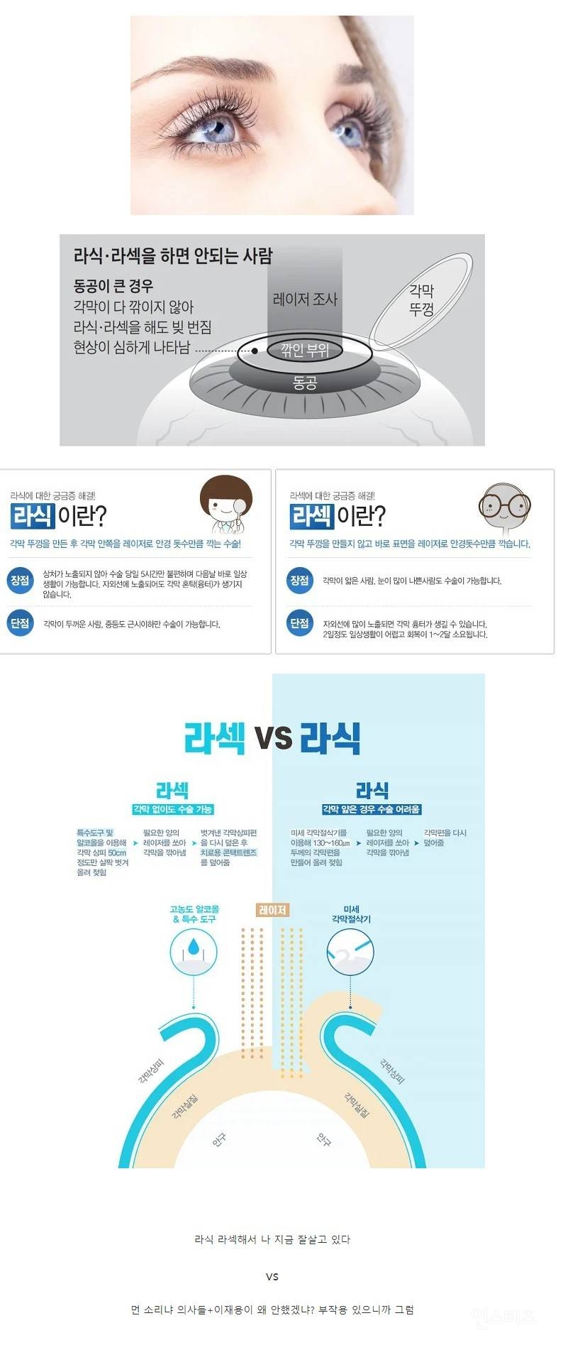 부작용 유무로 논란중인 수술 | 인스티즈