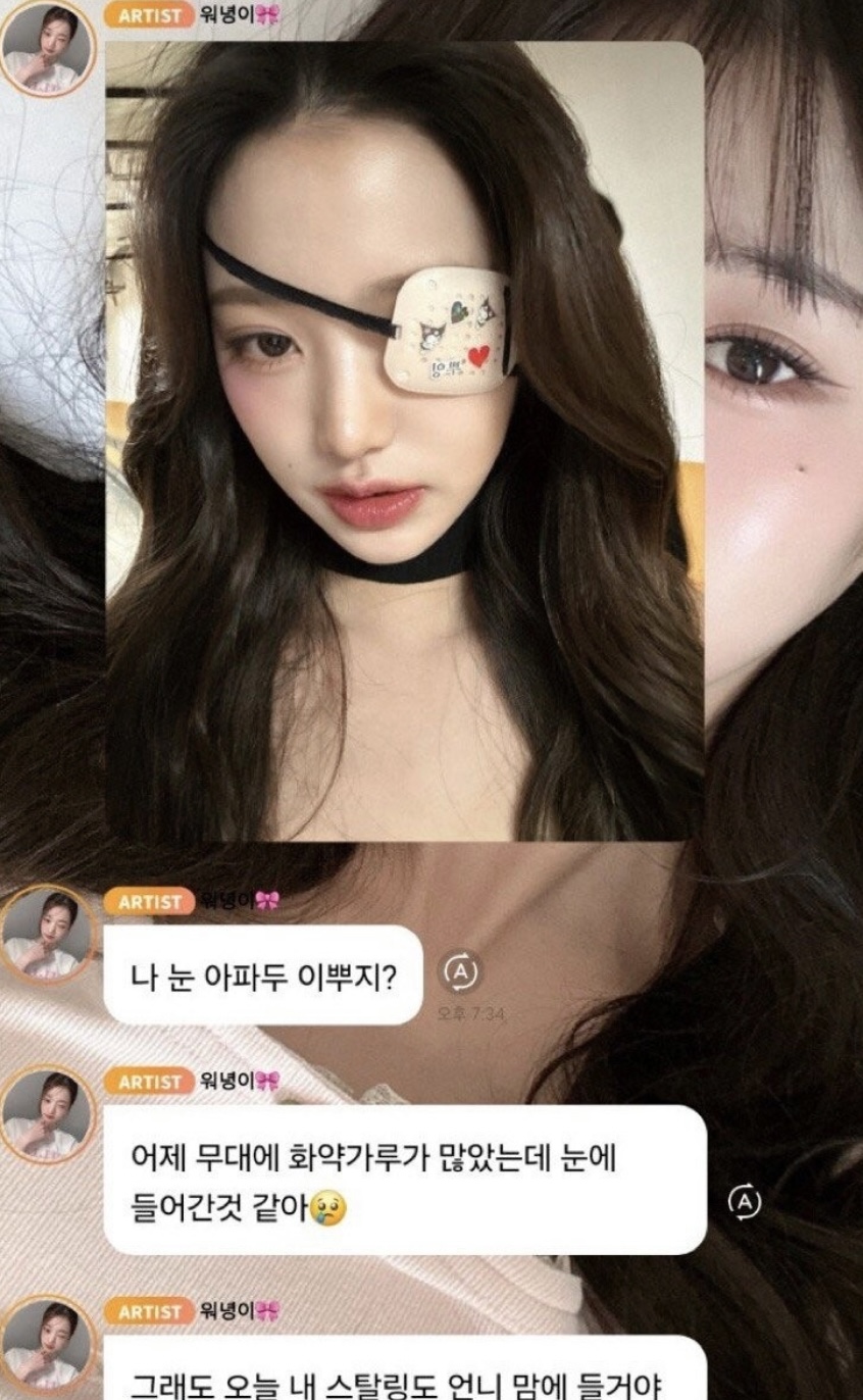 [잡담] 나 진짜 원영이 너무 좋아.. 이 안대썰 보고 더 좋아짐… | 인스티즈