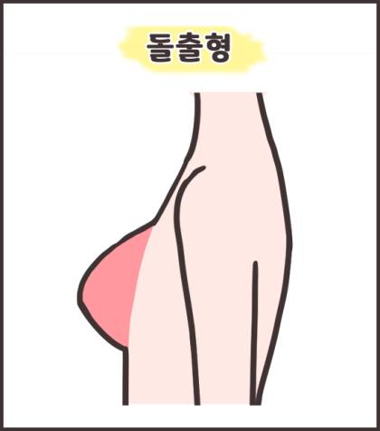 [잡담] 다들 가슴 모양 뭐에 가까워? | 인스티즈