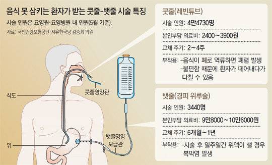 [잡담] 콧줄로 식사할 때 콧줄 어디까지 들어가는지 알아? | 인스티즈