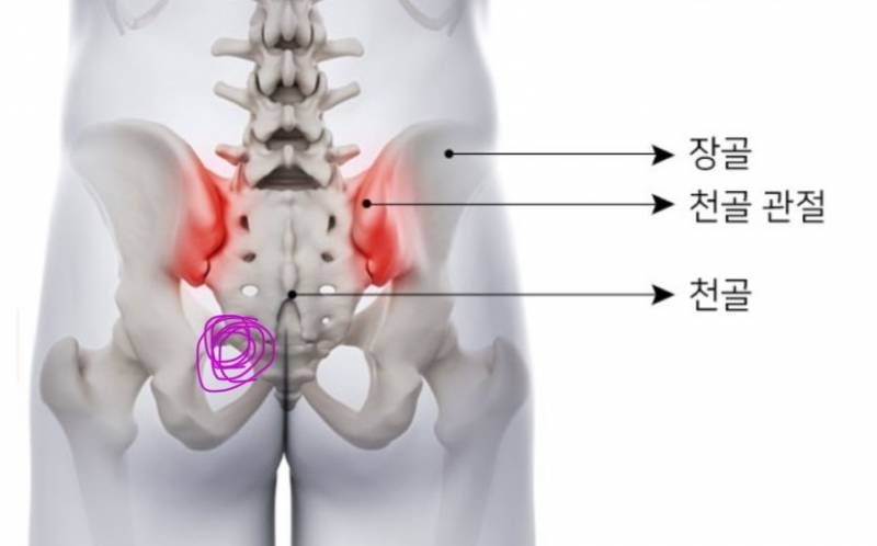 [잡담] 꼬리뼈? 천골? 어딘가가 뚜둑거리고 아픈데 뭔지 아는 사람ㅠ | 인스티즈