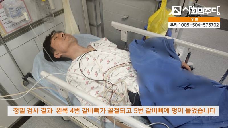 경찰 폭행에 국회의원 갈비뼈 골절 중상 | 인스티즈