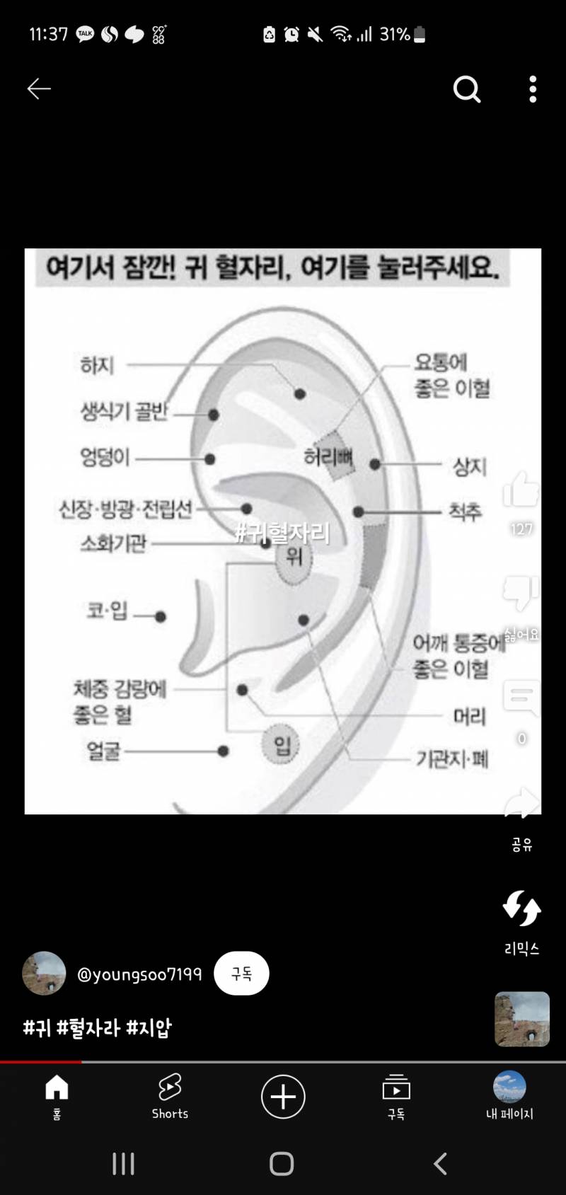 [잡담] 와...나 요즘 허리골반통증 심한데....귀 혈자리 누르니까 진짜 개아파.. | 인스티즈