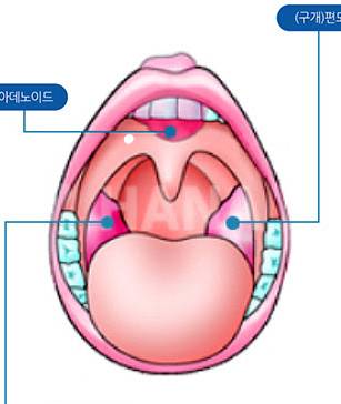 [잡담] 목안에? 입천장쪽에 뭐가 낫는데 뭘까 | 인스티즈