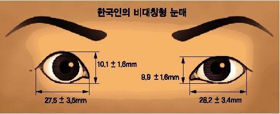 [잡담] 이거 딱 내 눈인데 남들이 봐도 이렇게 짝눈인 거 보일까?🥹 하 스트레스 받아🤦‍♀️ | 인스티즈