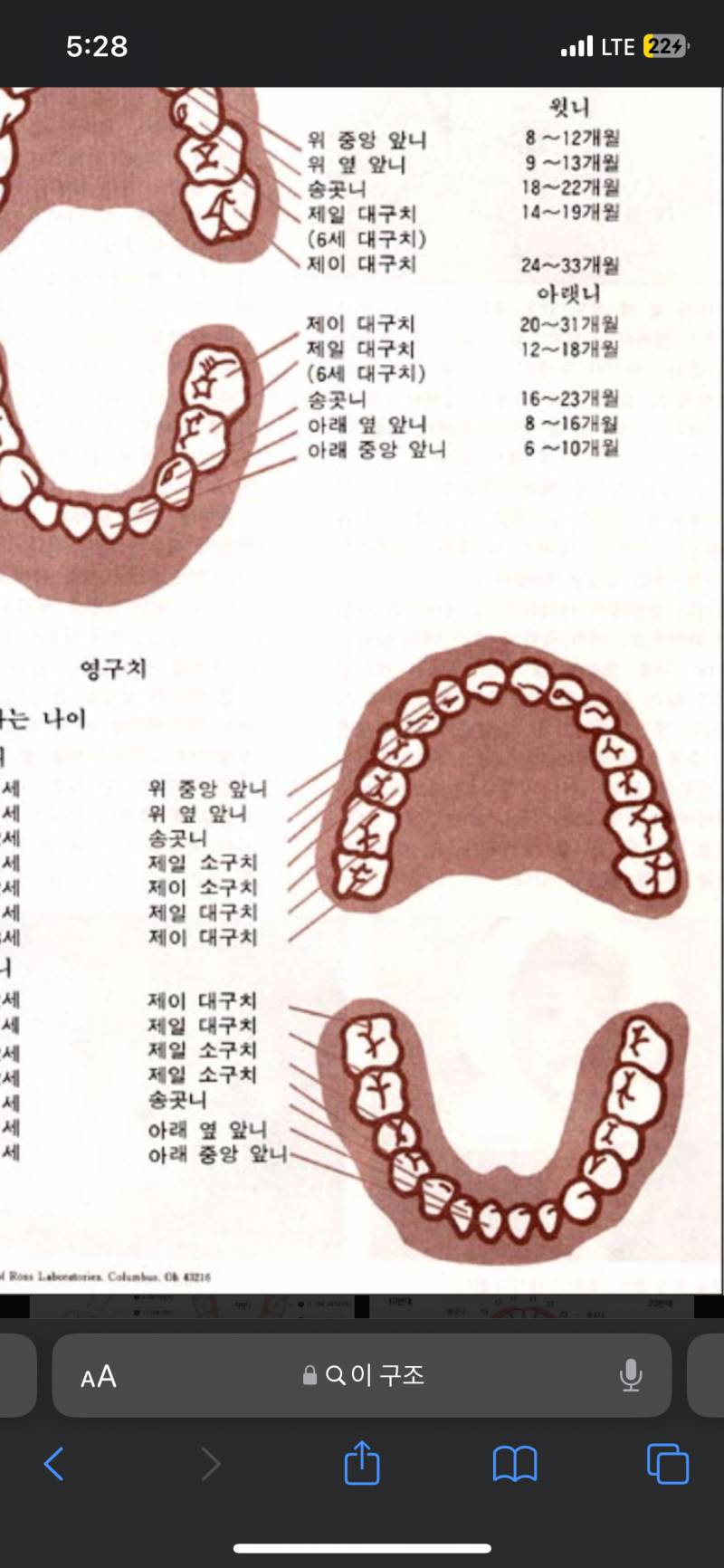 [잡담] 익들아 긎해!! 송곳니 만져지면 매복 아니야?? | 인스티즈