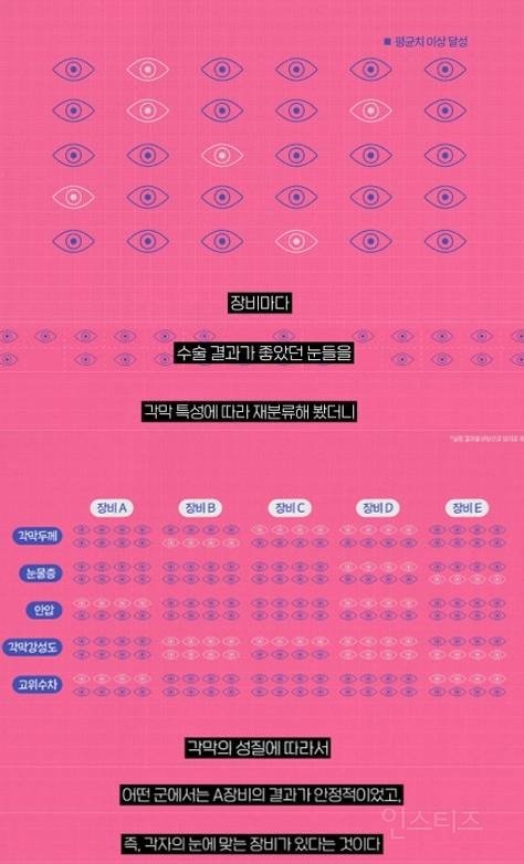 전 세계에서 처음으로 스마일라식 진실 밝혀낸 한국 안과의사 ㄷㄷ.jpg | 인스티즈