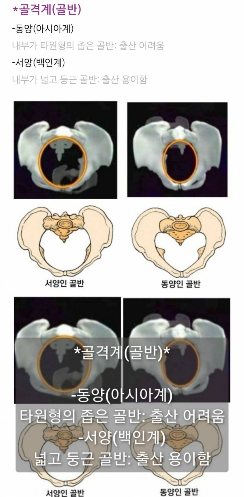 [잡담] 미국은 애낳으면 뛰어다니는데 동양인들 엄살이 심하다 | 인스티즈