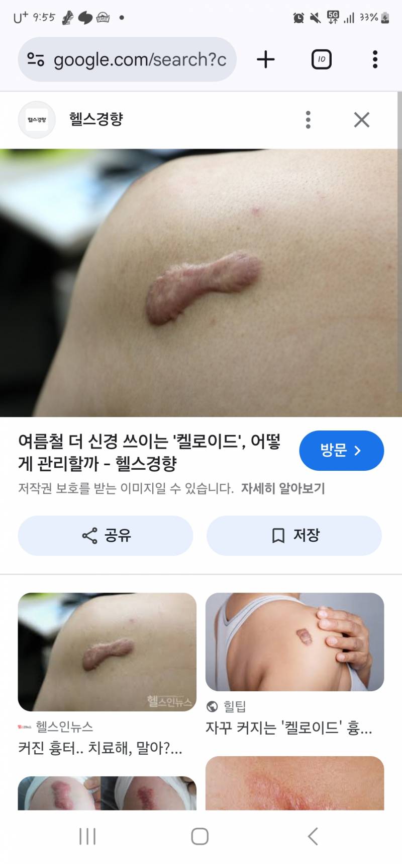 [잡담] ㅎㅇㅈㅇ나는 내몸 징그럽고싫어ㅠㅜㄴ | 인스티즈