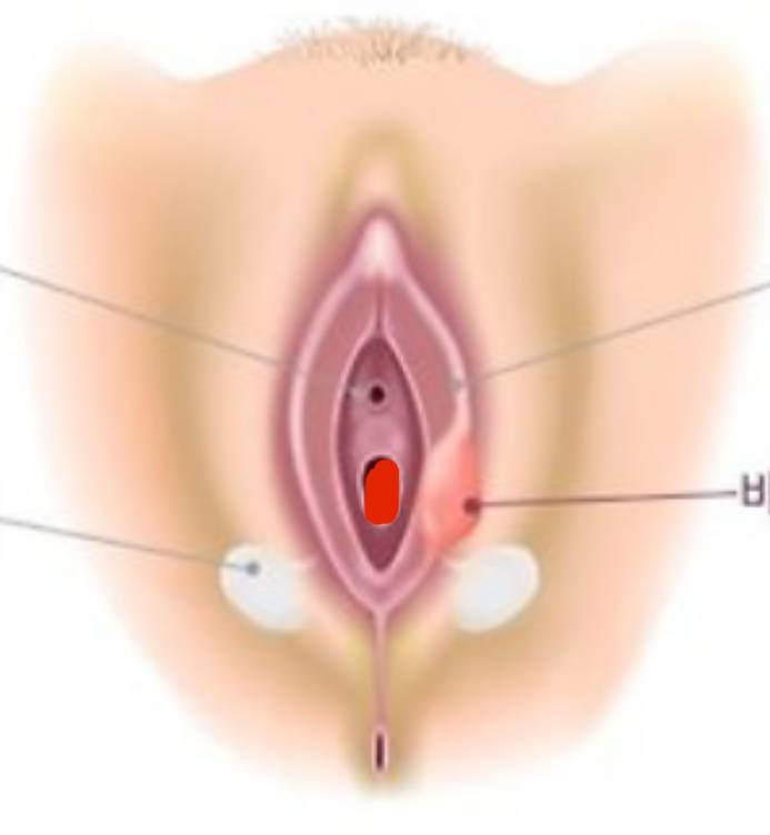 [잡담] 방금 생식기 혹(?) 관련해서 글올린 쓰닌데 | 인스티즈