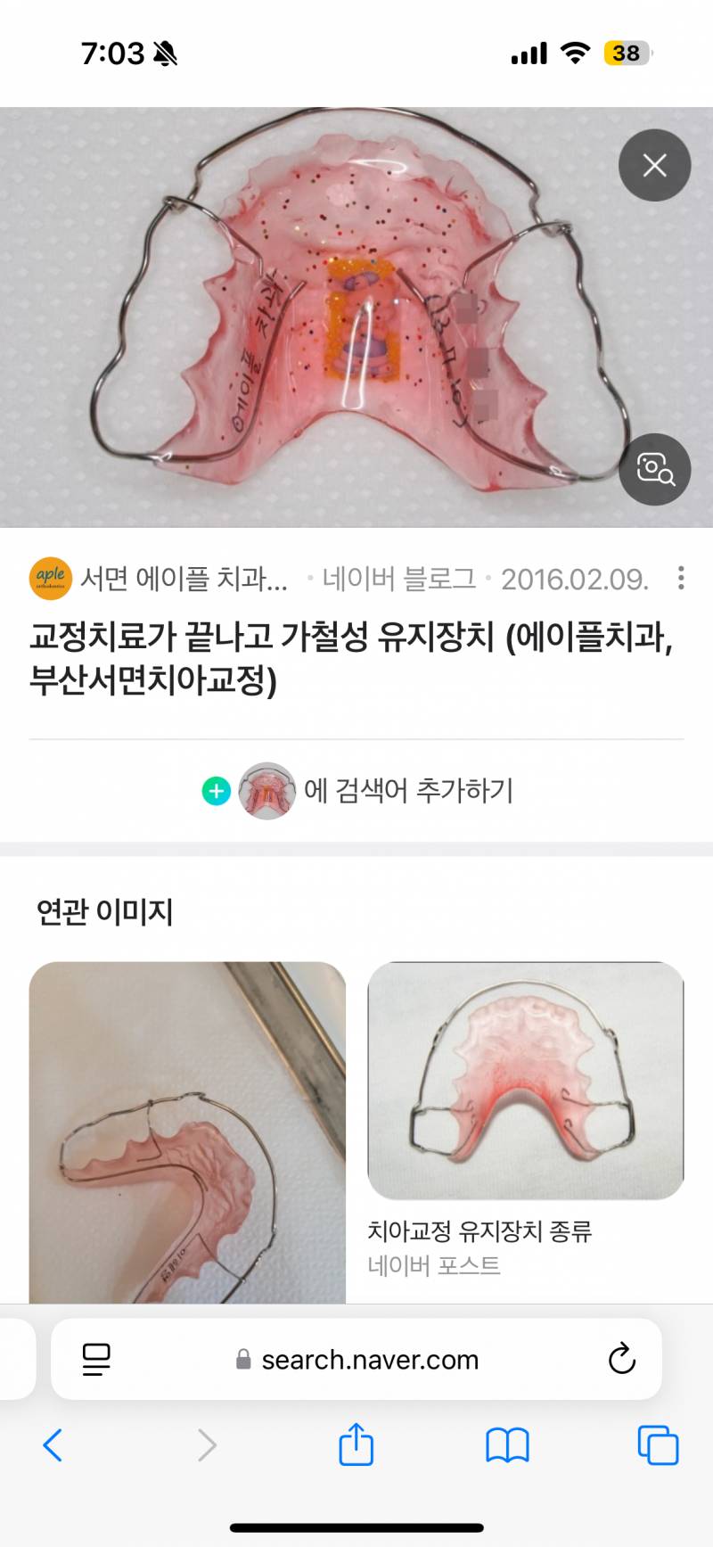 [잡담] 치아교정 가철성 유지장치 끼는 익들아 질문좀ㅠㅠㅠㅠㅠㅠㅠㅠㅠㅠㅠㅠㅠ | 인스티즈