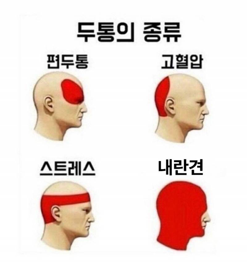 [잡담] 두통의종류 | 인스티즈