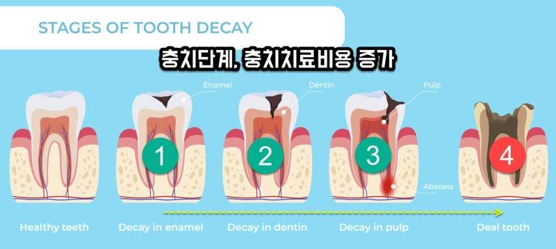 [잡담] 치통으로 죽ㅇ것 같아 | 인스티즈