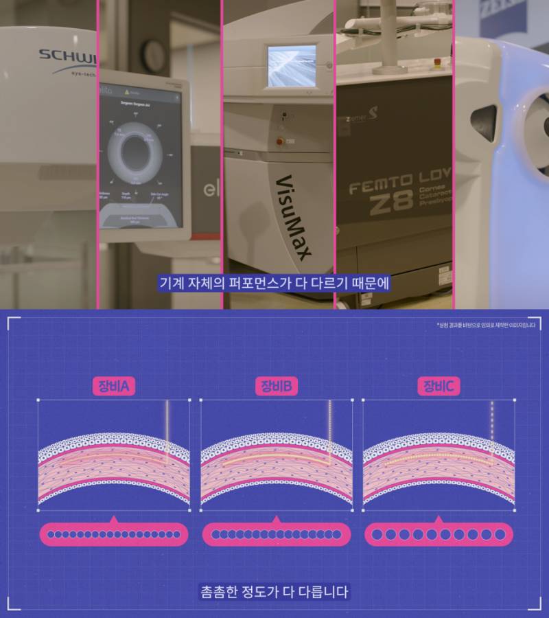 [정보/소식] 한국 안과에서 전세계 처음으로 해낸 것 | 인스티즈