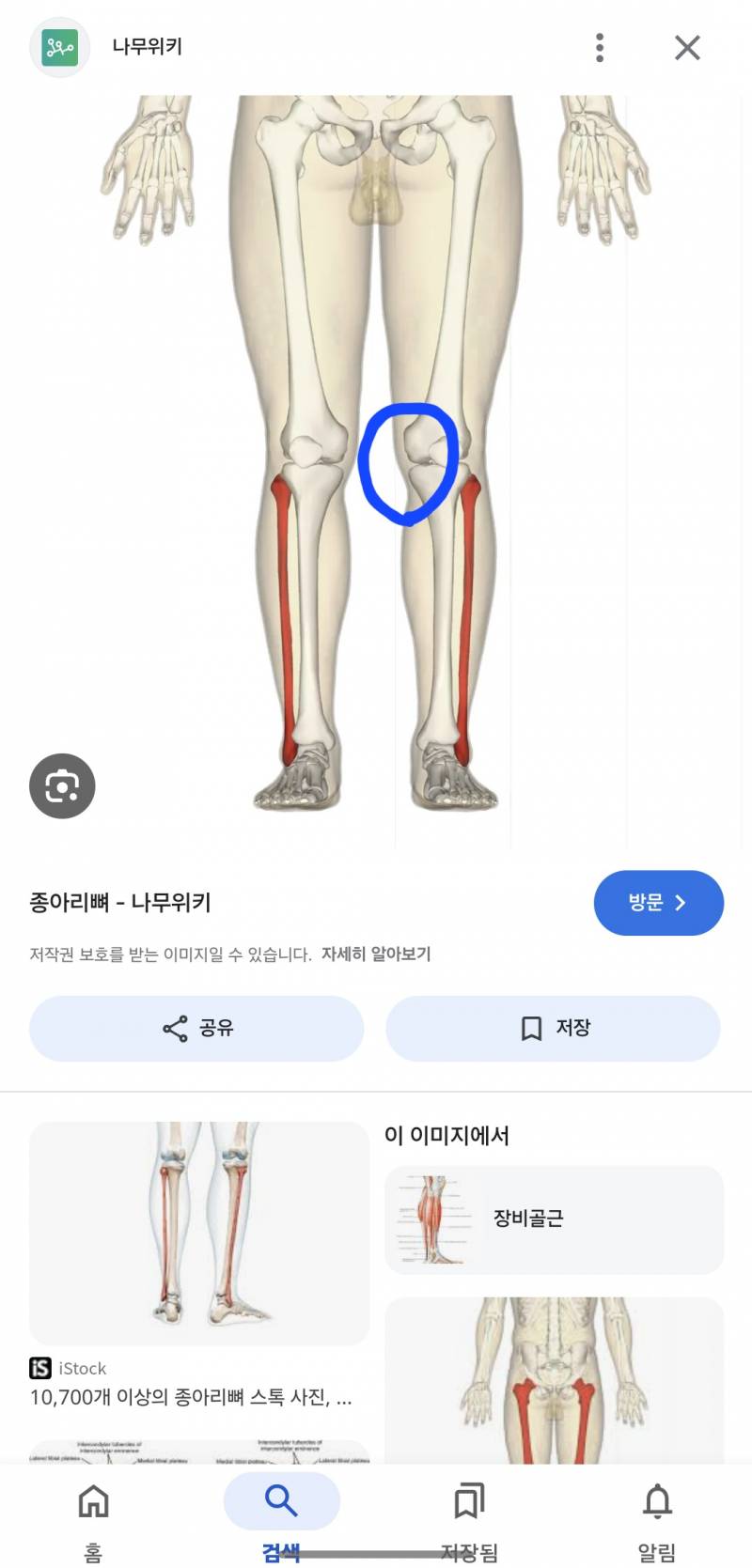 [잡담] 무릎뼈 이 쪽이 유독 튀어나와 보이는 이유가 뭘까 ㅠㅠ | 인스티즈