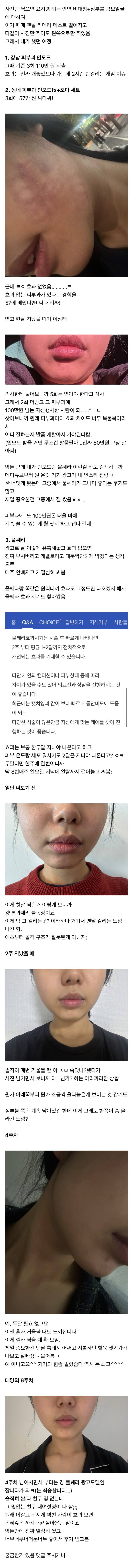 [팁/자료] 비대칭,심부볼 불독이 피부과 츄라이 실패하고 디바이스 60일 써본 후기 | 인스티즈